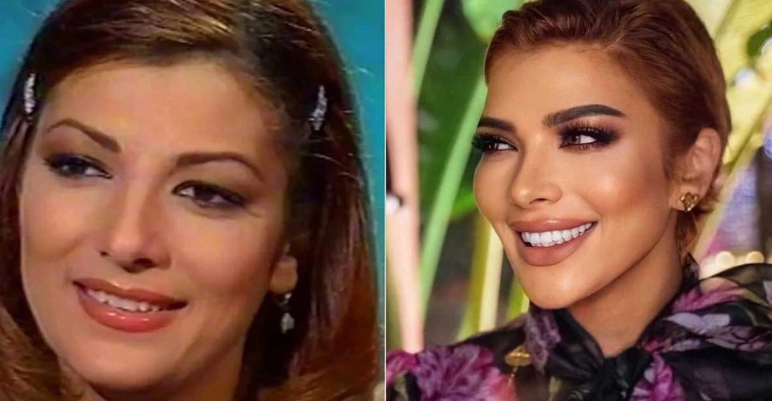 Asala before and after